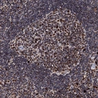 Immunohistochemical staining of human lymph node shows strong nuclear/cytoplasmic positivity in germinal center cells.