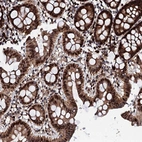 Immunohistochemical staining of human colon shows strong nuclear/cytoplasmic positivity in glandular cells and lymphoid cells.