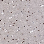 Immunohistochemical staining of human cerebral cortex shows strong nuclear positivity in neurons and glial cells.