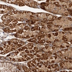 Anti-CSAD Antibody