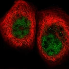 Immunofluorescent staining of human cell line A-431 shows localization to nuclear speckles.