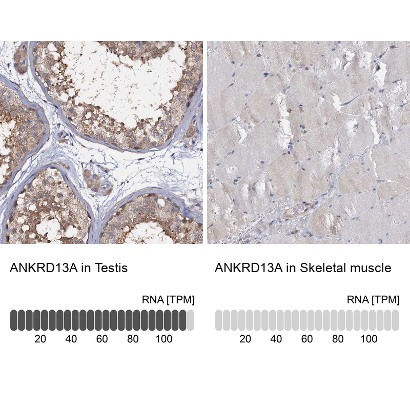 Anti-ANKRD13A Antibody