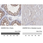 Anti-ANKRD13A Antibody