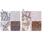 Immunohistochemical staining of human colon, skeletal muscle, testis and tonsil using Anti-ANKRD13A antibody HPA039488 (A) shows similar protein distribution across tissues to independent antibody HPA043218 (B).