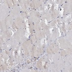 Immunohistochemical staining of human skeletal muscle shows low expression as expected.