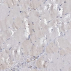 Immunohistochemical staining of human skeletal muscle shows low expression as expected.