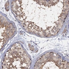 Immunohistochemical staining of human testis shows high expression.
