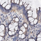 Immunohistochemical staining of human colon using Anti-ANKRD13A antibody HPA039488.