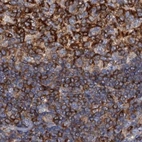 Immunohistochemical staining of human tonsil using Anti-ANKRD13A antibody HPA039488.