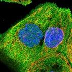 Immunofluorescent staining of human cell line A-431 shows localization to plasma membrane.