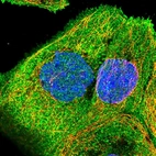Immunofluorescent staining of human cell line A-431 shows localization to plasma membrane.