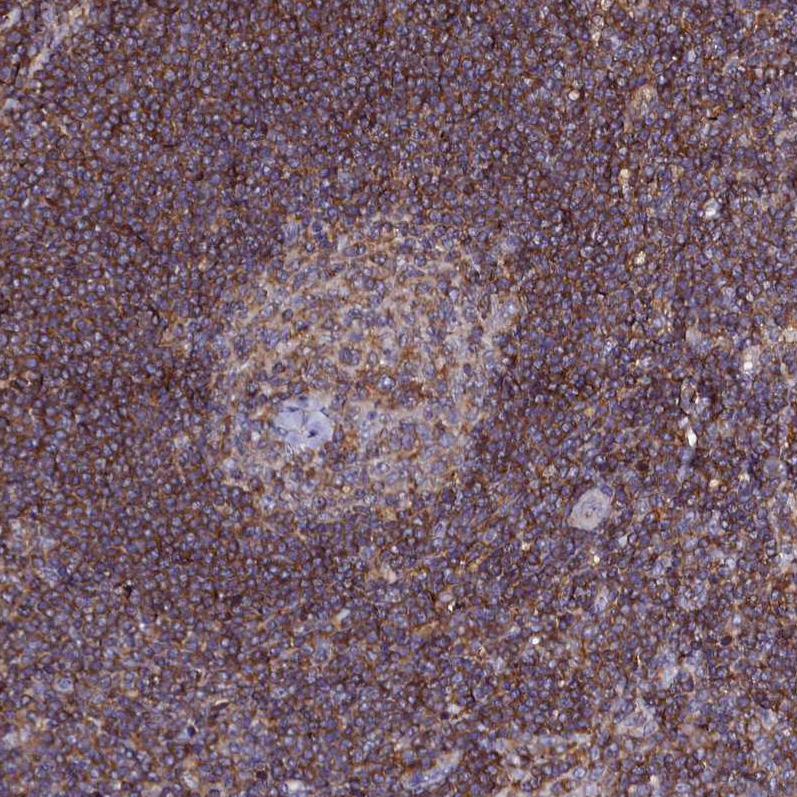 Anti-NCKAP1L Antibody