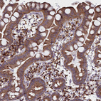 Immunohistochemical staining of human small intestine shows strong cytoplasmic positivity in lymphoid cells.