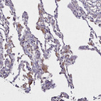 Immunohistochemical staining of human lung shows moderate cytoplasmic positivity in macrophages.