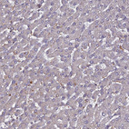 Immunohistochemical staining of human liver shows low positivity in hepatocytes as expected.