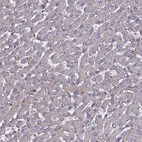 Immunohistochemical staining of human liver shows low positivity in hepatocytes as expected.