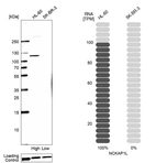 Western blot analysis in human cell lines HL-60 and SK-BR-3 using Anti-NCKAP1L antibody. Corresponding NCKAP1L RNA-seq data are presented for the same cell lines. Loading control: Anti-COX4I1.
