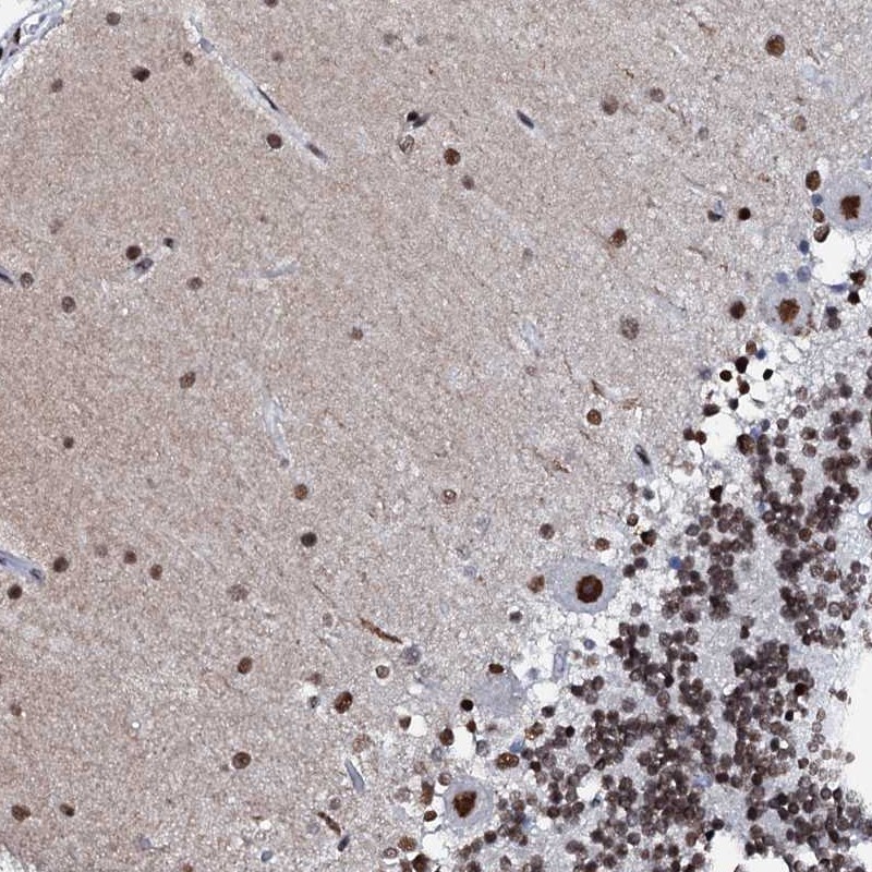 Anti-C11orf57 Antibody