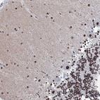 Anti-C11orf57 Antibody