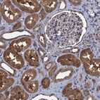 Anti-CNTN5 Antibody