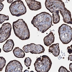 Immunohistochemical staining of human placenta shows strong membranous positivity in trophoblastic cells.