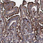 Immunohistochemical staining of human small intestine shows positivity in luminal membrane in glandular cells.