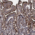 Immunohistochemical staining of human small intestine shows positivity in luminal membrane in glandular cells.