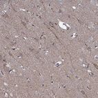 Immunohistochemical staining of human cerebral cortex shows weak membranous positivity in neurons.