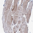 Immunohistochemical staining of human skeletal muscle shows weak cytoplasmic-membranous positivity in myocytes.