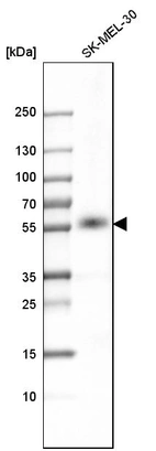 Western blot analysis in human cell line SK-MEL-30.