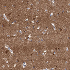 Anti-NLRP10 Antibody