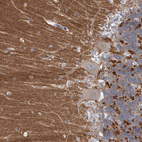 Immunohistochemical staining of human cerebellum shows strong cytoplasmic positivity in cells in molecular layer.