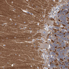 Anti-NLRP10 Antibody