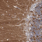 Immunohistochemical staining of human cerebellum shows strong cytoplasmic positivity in cells in molecular layer.
