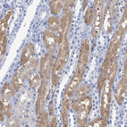 Immunohistochemical staining of human kidney shows moderate cytoplasmic positivity in cells in tubules.