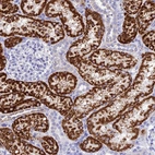Immunohistochemical staining of human kidney shows strong granular cytoplasmic positivity in cells in tubules.