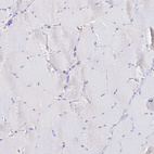 Immunohistochemical staining of human skeletal muscle shows no positivity in myocytes as expected.