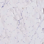 Immunohistochemical staining of human skeletal muscle shows no positivity in myocytes as expected.