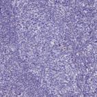 Immunohistochemical staining of human tonsil shows no positivity in germinal center cells as expected.