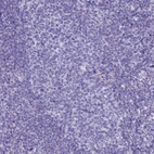 Immunohistochemical staining of human tonsil shows no positivity in germinal center cells as expected.