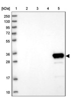 Lane 1: Marker [kDa] 250, 130, 95, 72, 55, 36, 28, 17, 10_br/_Lane 2: Human cell line RT-4_br/_Lane 3: Human cell line U-251MG sp_br/_Lane 4: Human plasma (IgG/HSA depleted)_br/_Lane 5: Human liver tissue
