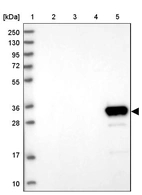 Lane 1: Marker [kDa] 250, 130, 95, 72, 55, 36, 28, 17, 10_br/_Lane 2: Human cell line RT-4_br/_Lane 3: Human cell line U-251MG sp_br/_Lane 4: Human plasma (IgG/HSA depleted)_br/_Lane 5: Human liver tissue