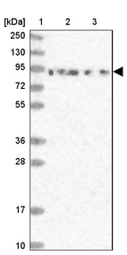 Lane 1: Marker [kDa] 250, 130, 95, 72, 55, 36, 28, 17, 10_br/_Lane 2: Human cell line RT-4_br/_Lane 3: Human cell line U-251MG sp