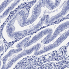 Immunohistochemical staining of human endometrium shows no positivity in glandular cells as expected.