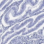Immunohistochemical staining of human endometrium shows no positivity in glandular cells as expected.