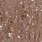 Immunohistochemical staining of human cerebral cortex shows strong cytoplasmic positivity in neurons.