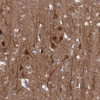 Immunohistochemical staining of human cerebral cortex shows strong cytoplasmic positivity in neurons.