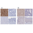 Immunohistochemical staining of human cerebral cortex, endometrium, liver and skin using Anti-FBXL16 antibody HPA039504 (A) shows similar protein distribution across tissues to independent antibody HPA056354 (B).