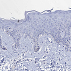 Immunohistochemical staining of human skin shows no positivity in squamous epithelial cells as expected.