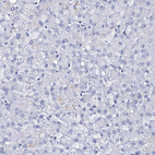 Immunohistochemical staining of human liver shows no positivity in hepatocytes as expected.